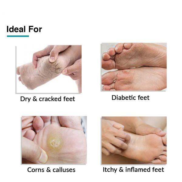 Fixderma Foobetik Foot Cream, 100gm