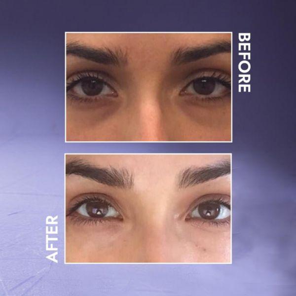 BiE Eyefinity - All-in-one Under Eye Gel visibily reduces puffiness & lines, 15gm